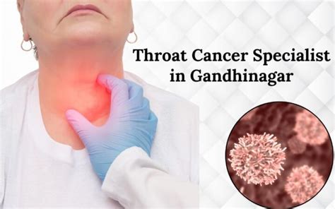 Understanding Throat Cancer: A Comprehensive Overview