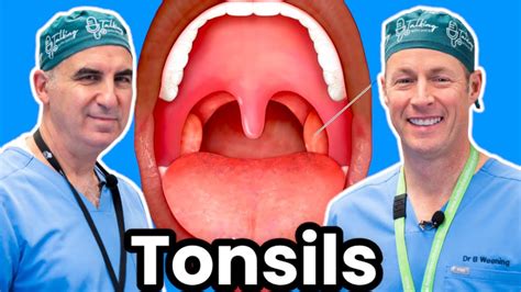 Understanding Tonsils: A Brief Overview