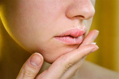 Understanding the Common Causes of Swollen Lips