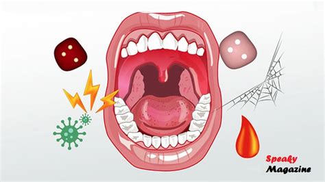 Understanding the Common Triggers of Oral Infections