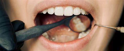 Understanding the Connection between Tooth Loss and Self-Image