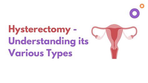 Understanding the Different Types of Hysterectomy