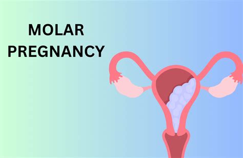 Understanding the Enigma of Imaginary Pregnancy