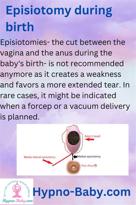 Understanding the Episiotomy Nightmare