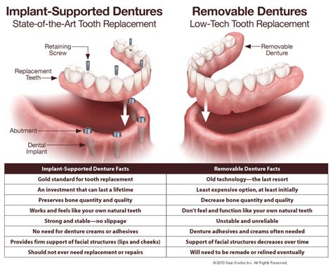 Understanding the Factors Behind Denture Instability