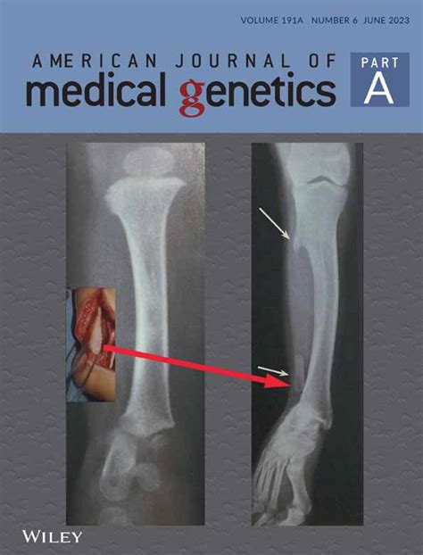 Understanding the Genetics Behind Bifurcated Anomalies