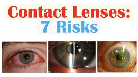 Understanding the Impact of Eye Infections and Their Consequences