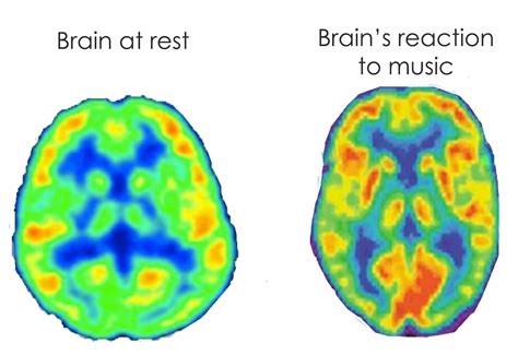 Understanding the Impact of Music on Dream Content and Emotional States