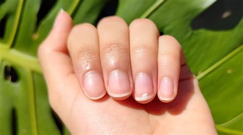 Understanding the Impact of Stress on Nail Health in Dreams