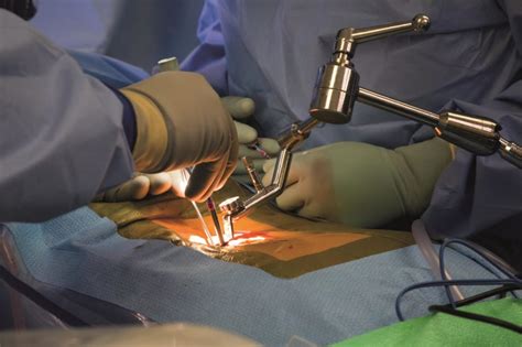 Understanding the Importance of Spinal Surgical Intervention