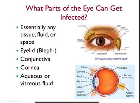 Understanding the Origins of Ocular Infections