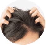 Understanding the Origins of an Itchy Scalp