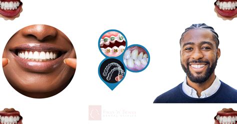 Understanding the Significance of Well-Aligned Teeth