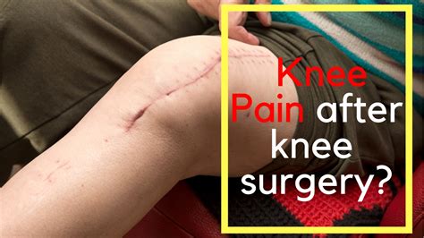 Unlocking the Hidden Significance Behind Visions of Knee Surgery