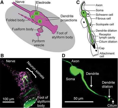 Unraveling the Profound Significance of Retrieving Fibrous Material from the Auditory Organ