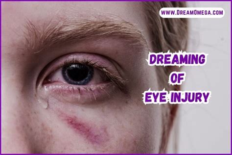 Unraveling the Psychological Significance of Dreaming with an Injured Eye