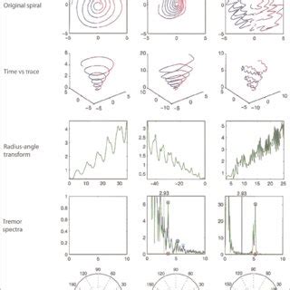 Unraveling the Significance of Tremors in Vertical Conveyance Reveries