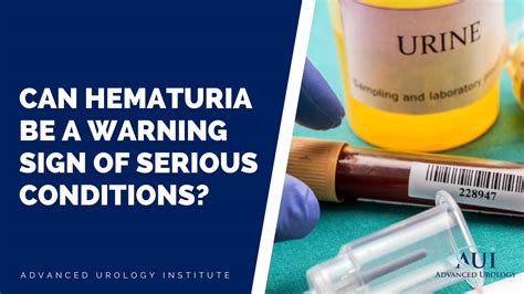 Unveiling Rare Disorders: Hematuria as a Sign of Something Serious