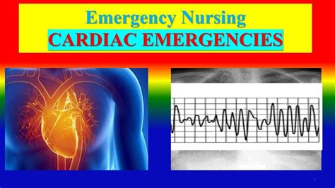 Unveiling the Enigmatic Significance of a Cardiac Emergency