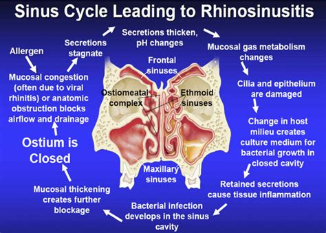 Unveiling the Mysterious Phenomenon of Prolonged Nasal Secretions