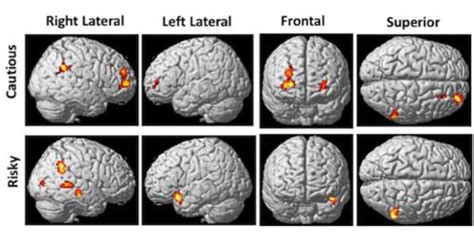 Unveiling the Neurological Mechanisms of Visual Gestures