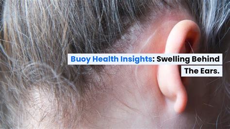 When to Seek Medical Assistance for Swollen Ear