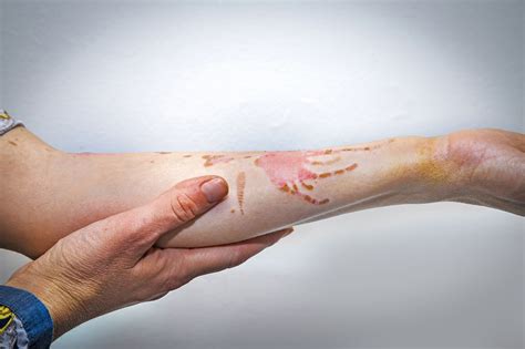 When to Seek Medical Help for Patches on the Epidermis